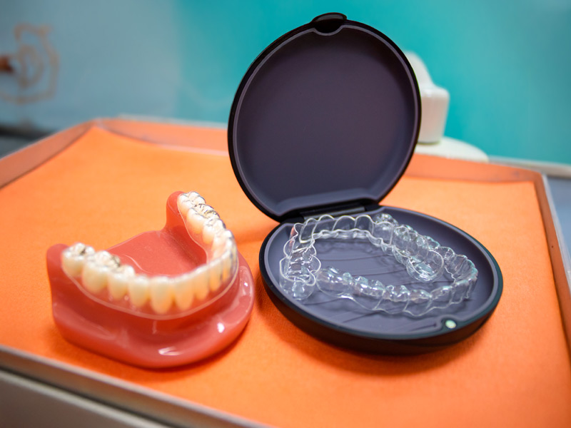 brackets invisibles y baratos en dentista en Fuenlabrada y Humanes de Madrid