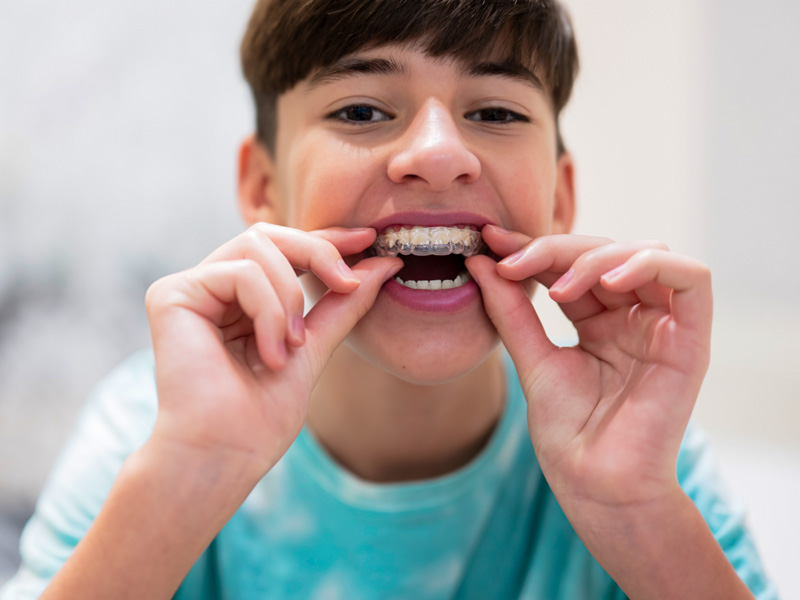 precio de ortodoncia para jóvenes y adultos en clínica dental Fuenlabrada